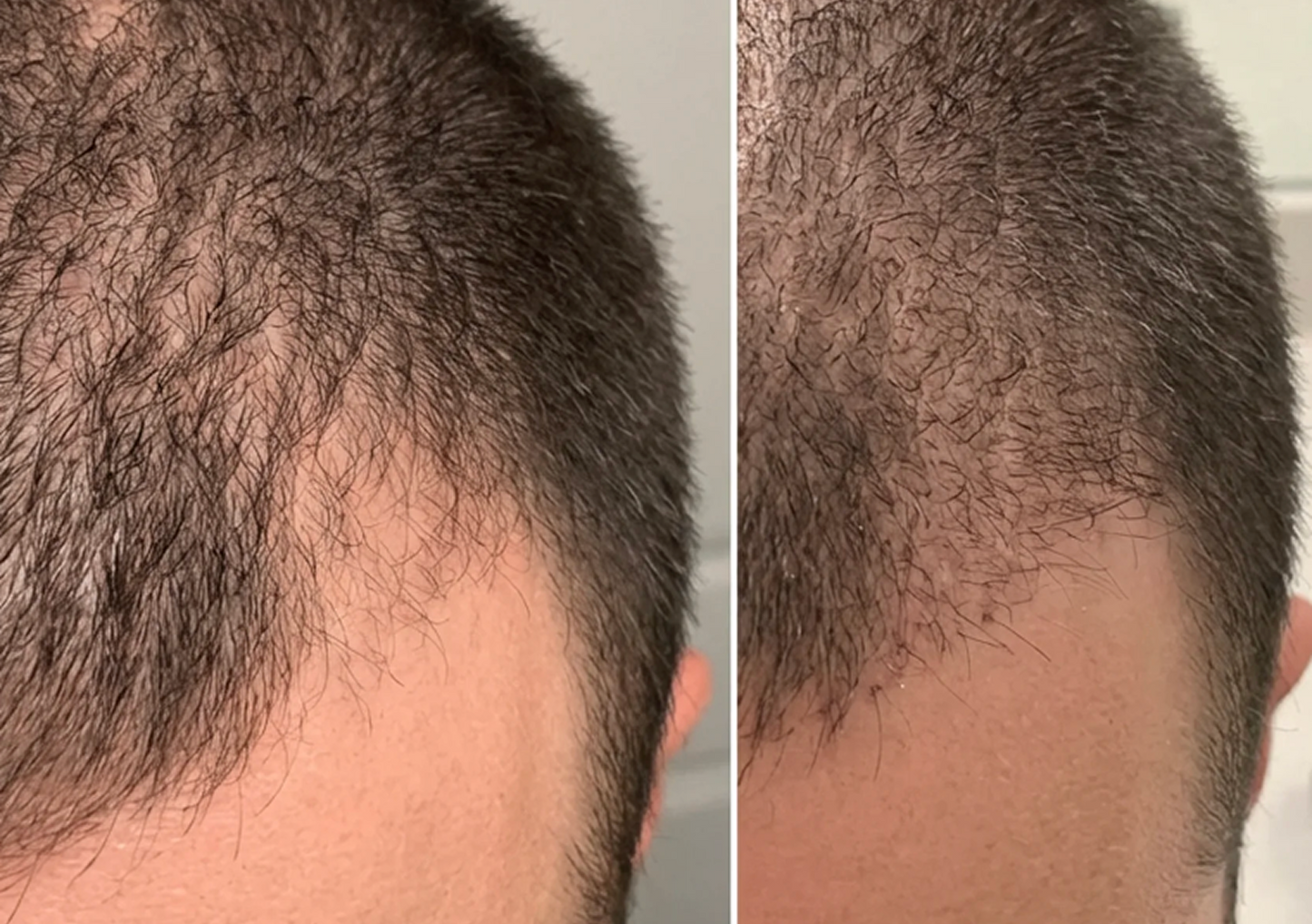Olapen For Hair
